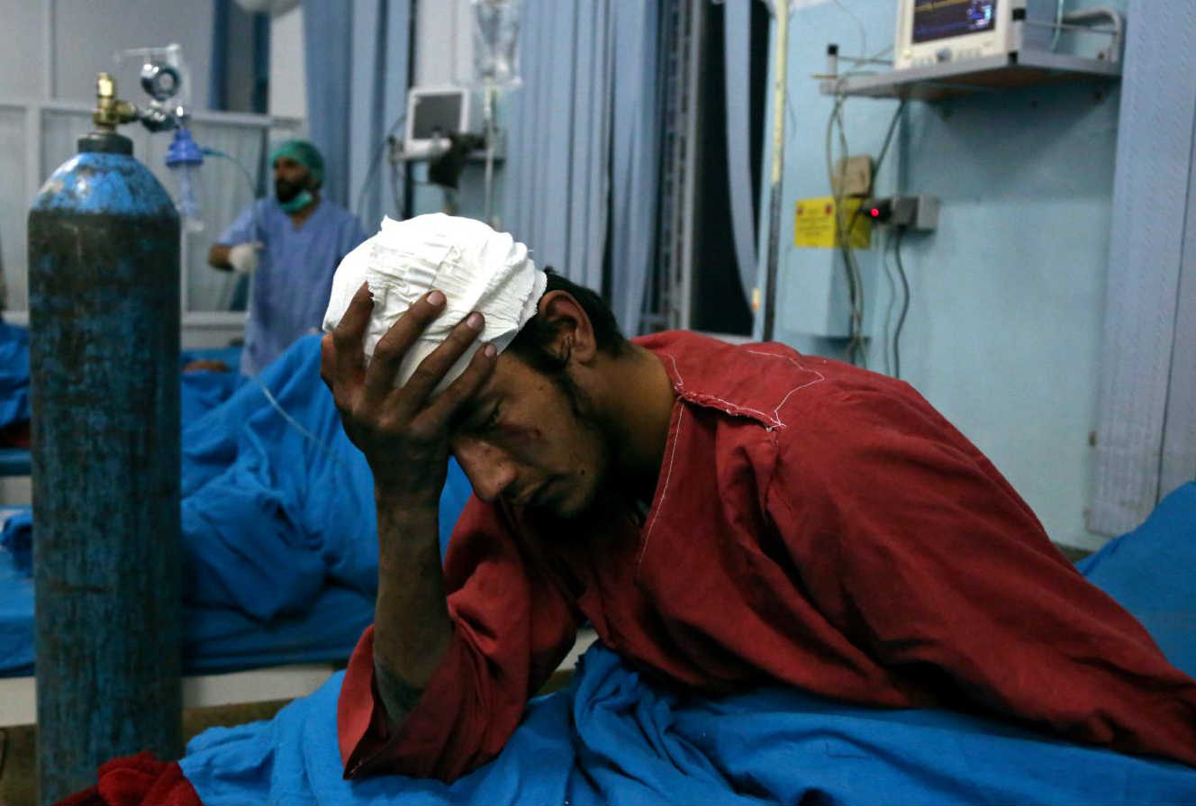 Ranjeni čovek u bolnici u Kabulu nakon samoubilačkog bombaškog napada (Foto: Rahmat Gul/AP)